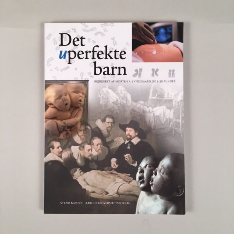 Det uperfekte barn 1